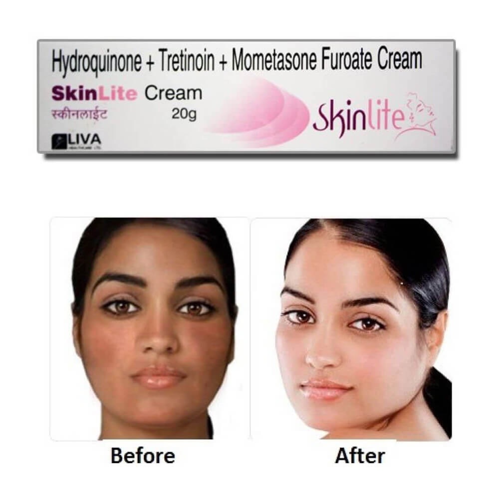 Skinlite Cream Uses ubicaciondepersonas.cdmx.gob.mx