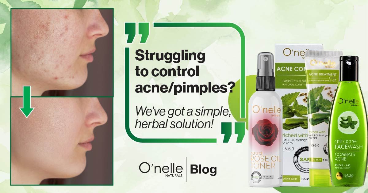 ONELLA ACNE PIMPLE FACE WASH -100ml. 