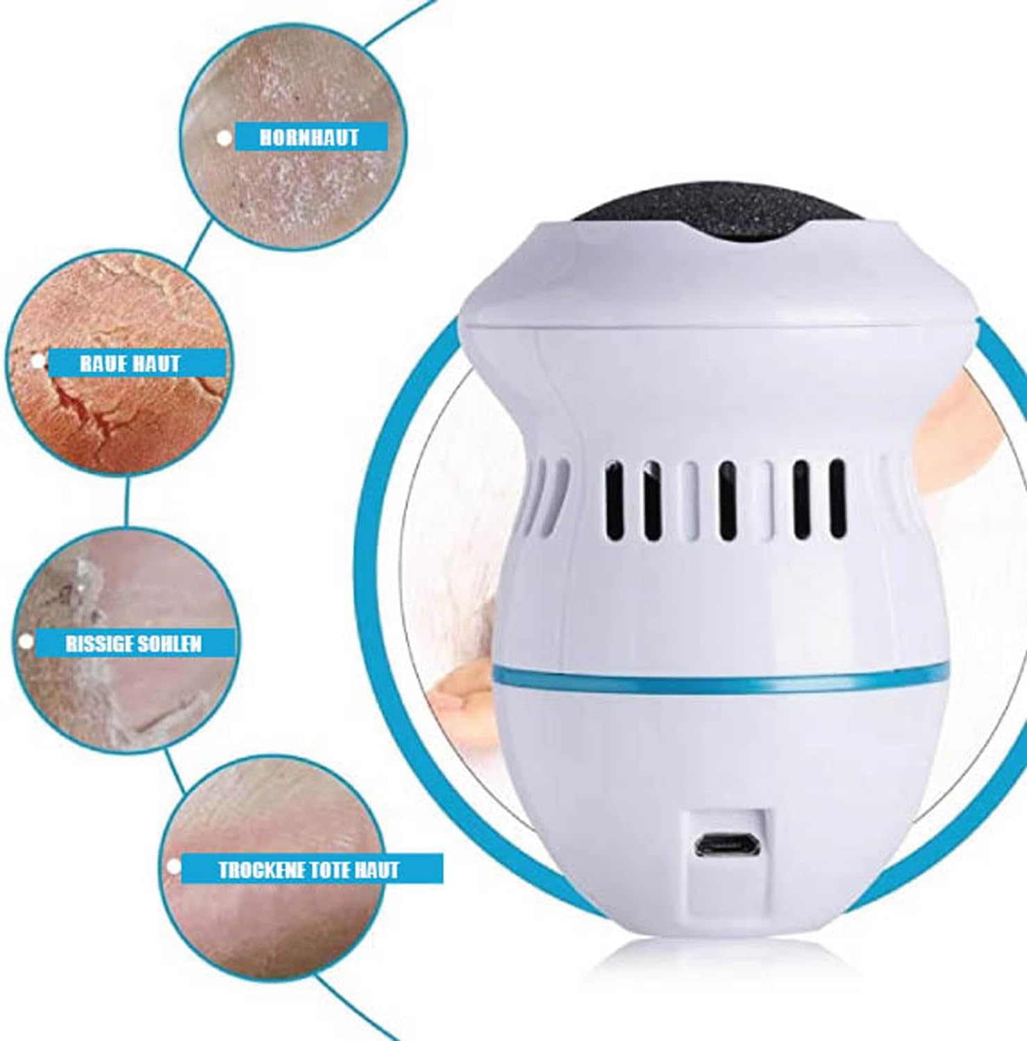 Electric Callus Remover, Callus Removal, Foot Rechargeable, Pedicure Set, Foot Care, Callus Remover, Foot Care Device, Electric 6 Attachments. 