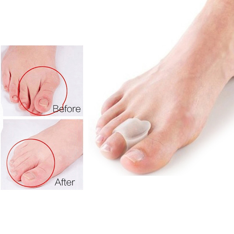 Big Toe Straightener Thumb Valgus Protector Silicone Gel Foot Fingers ...